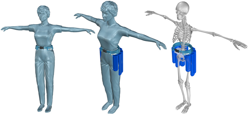 Illustration for article titled An Airbag Belt Could Help Protect Seniors' Hips From Nasty Falls